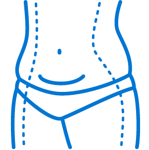 Liposuction